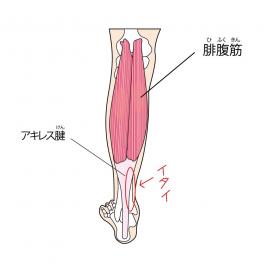 アキレス腱周囲炎